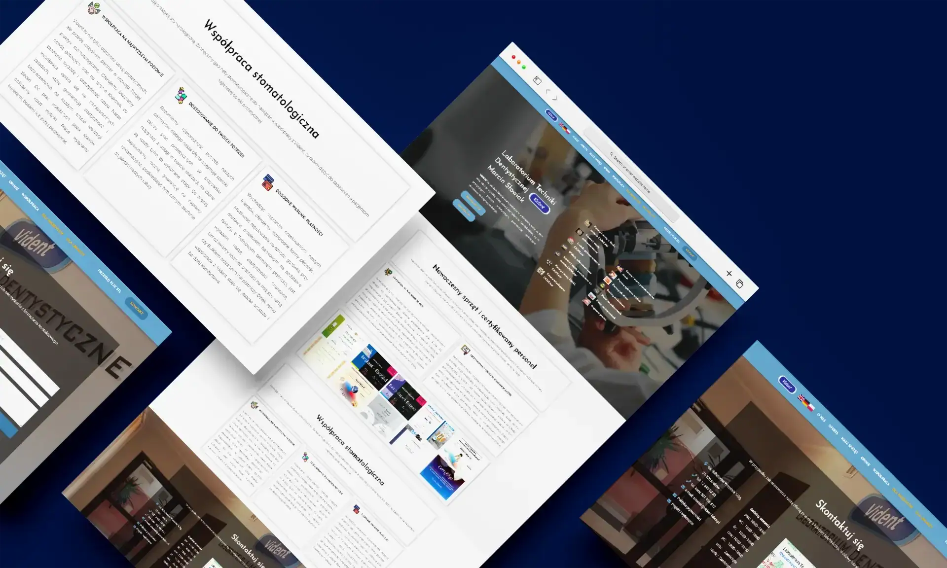 A digital screenshot of a dental laboratory website with multiple webpages open, displaying services, news, and contact information.